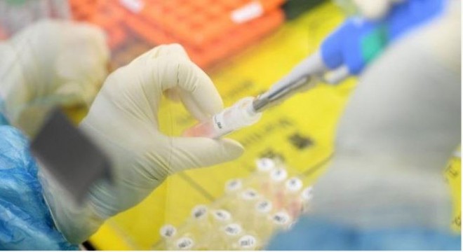 Doğu'da 11 Covid-19 tanı laboratuvarı hizmet veriyor